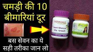 Patanjali Neem Ghan Vati amp Kayakalp Vati Benefits For Psoriasis ringworm amp Fungal Infection [upl. by Illom]