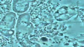 Guérir votre gencive par la microscopie entamoeba gingivalis amibe [upl. by Harat]