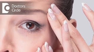 Causes amp Tips to manage burning skin around eyes  Dr Rasya Dixit [upl. by Ailee]