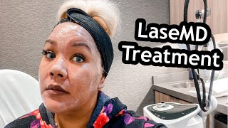 LaseMD Before And After  LaseMD Treatment  Laser Treatment Before And After  It Didnt Even Hurt [upl. by Gennie]