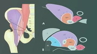 Échographie et pubalgie  partie 4  Face antérieure de la hanche et psoas [upl. by Okkin407]