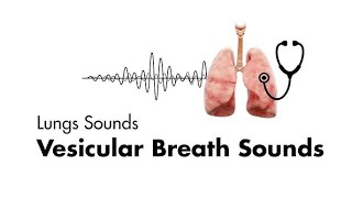 Breath Sounds in Different Clinical Conditions on Examination [upl. by Obnukotalo]