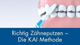 Richtig Zähneputzen  Die KAI Methode [upl. by Eical290]