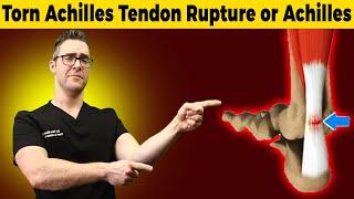 Torn Achilles Tendon Rupture or Achilles Tendonitis HOW TO TELL [upl. by Idhem980]