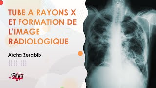 Radiologie  TUBE A RAYONS X ET FORMATION DE L’IMAGE RADIOLOGIQUE par AICHA ZERABIB [upl. by Keverne]