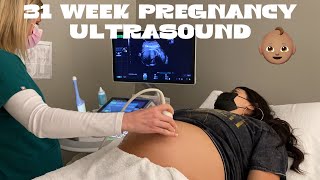 31 Week Pregnancy Ultrasound  8 Month Pregnancy [upl. by Atnohs260]