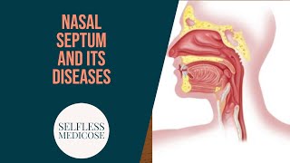 NASAL SEPTUM and DISEASES part 2 DEVIATED NASAL SEPTUM [upl. by Ahsikel]