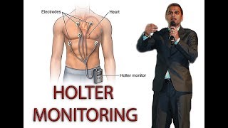 HOLTER MONITORING [upl. by Haiacim833]