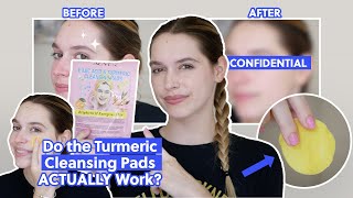 I Tried the Viral Kojic Acid amp Turmeric Cleansing Pads You’ve Seen All Over TikTok  Take My Money [upl. by Tita]