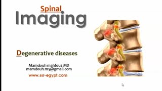 Spinal imaging Degenerative diseases II DRE Prof Mamdouh Mahfouz [upl. by Aisela]