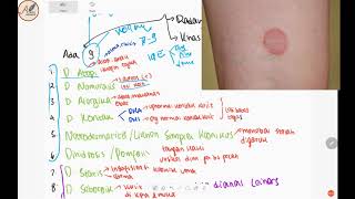 9 Jenis Dermatitis  Review Singkat Klasifikasi Dermatitis [upl. by Hareehahs]