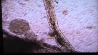 Cardiomyocyte Fibrin Contraction [upl. by Wojcik]