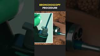 bronchoscopy procedure bscnursing ytshorts medicalstudent doctor lungs nursing [upl. by Sela]