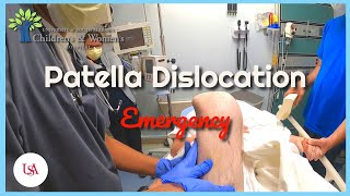 Patella Dislocation Emergency [upl. by Henriette]