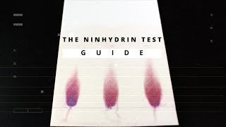 Ninhydrin Test A Detailed Guide to The Amines and Amino Acids Determination [upl. by Adirehs]