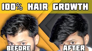 Best Hair Growth Technique  இத follow பண்ணா கண்டிப்பா முடி வளரும்  Tamil  Shadhik Azeez [upl. by Icyac]