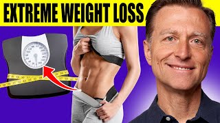 The Ultimate Fat Burning Guide Dr Bergs Webinar on Maximum Weight Loss [upl. by Enirak]