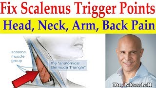 Fix Scalenus Trigger Points Quick Relief to Head Neck Arm Upper Back Pain  Dr Alan Mandell DC [upl. by Nalrah203]