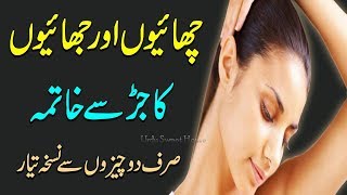 Melasma Remedy Chehre ki Chaiyon ka Ilaaj Ab Bohat Aasan  IN 3 DAYRemove Pigmentation Brown Spot [upl. by Lotz]