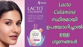 Lacto Calamine Face Lotion  Oil Control Face Cream For Daily Use  Paraben Free Formula [upl. by Philander673]