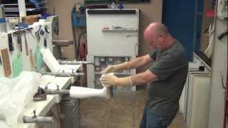 AFO Partial Foot Prosthesis Part 1 [upl. by Winter]