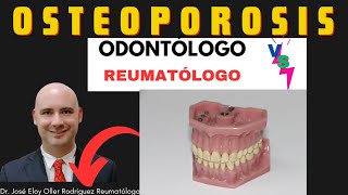 osteoporosis ODONTóLOGO no me atiende prolia actonel bonviva fosamax denosumab [upl. by Delisle]