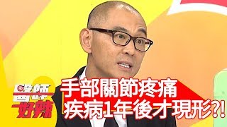 手部關節疼痛，疾病1年後才現形？！【醫師好辣】20200203 part1 EP886 賈蔚 陳保仁 [upl. by Llenrev]