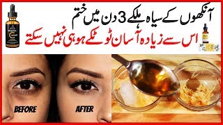 Remove Dark Circles Natural Home Remedies Also Get Rid of Under Eye Wrinkles in 3 Days Urdu Hindi [upl. by Othelia]