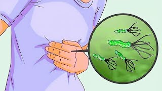 6 Remédios Caseiros para Eliminar a Bactéria H Pylori [upl. by Olaf871]