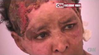 Gaddafis Son Wife Burnt the Face of Ethiopian Woman  CNN [upl. by Angeli]