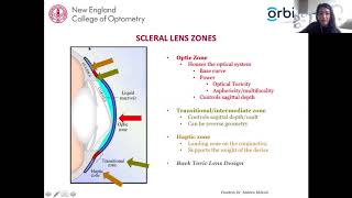 Scleral Lens Assessment and Fitting [upl. by Cassandre318]