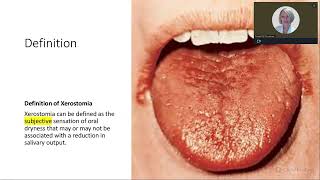 XEROSTOMIA TREATING DRY MOUTH TO IMPROVE PATIENT OUTCOMES [upl. by Meriel]