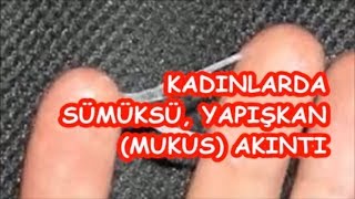 KADINLARDA SÜMÜKSÜ YAPIŞKAN MUKUS AKINTI [upl. by Plank766]