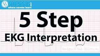 EKG Basics  How to Read amp Interpret EKGs Updated Lecture [upl. by Iot21]