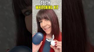 Teeth Whitening Procedure – What to Expect [upl. by Aliel]