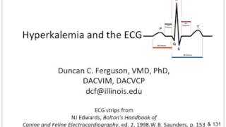 Hyperkalemia and the ECG [upl. by Arianne]