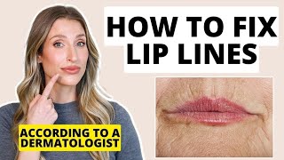 How to Fix Lip Lines  Dermatologist Shares Treatments for Lip Wrinkles [upl. by Freberg297]