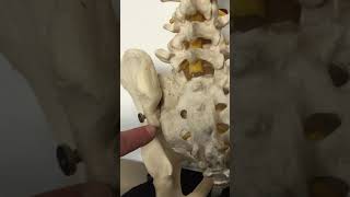 Rhizotomy of the SacroIliac Joint [upl. by Hahseram]