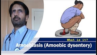 Amoebiasis Amoebic dysentery  Causes of dysentery [upl. by Eitisahc538]