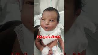 High grade bilirubin nicu reels niculife newbornbaby cute cutebaby [upl. by Eardna]