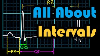 Corrected QT interval QTc calculation with Bazetts formula [upl. by Haduj902]