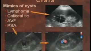 Practical Reviews in Ultrasound Kidneys amp Adrenals [upl. by Ruffina]