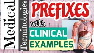 Medical TerminologyPrefixes in detail  Clinical Examples medicalcoding NusingMedicineStudents [upl. by Solitta725]