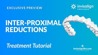 IPR with Invisalign Treatment [upl. by Adlai]