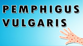 Pemphigus Vulgaris Symptoms Treatment and Causes [upl. by Sane768]