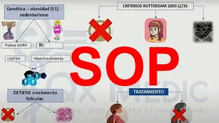 Síndrome de Ovario Poliquístico  SOP [upl. by Daphie]