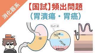 【国試対策】胃の疾患（胃潰瘍・胃がん・ダンピング症候群） [upl. by Honebein]