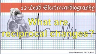 What are reciprocal changes [upl. by Ahsauqram]