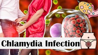 Chlamydia Infection  Causes Risk Factors Transmission Signs amp Symptoms Diagnosis amp Treatment [upl. by Liahus699]