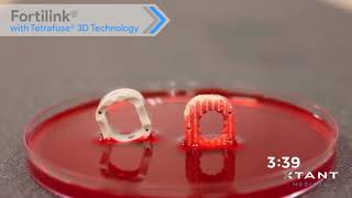 Xtant Medical Fortilink® with Tetrafuse® 3D Technology [upl. by Aneehs]